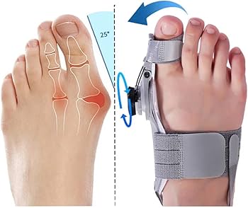 👣 Camina sin dolor: el corrector de juanetes que realmente funciona 👟 Diseñado para tus pies, pensado para tu salud!